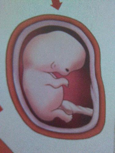 fetus - The baby in the womb.