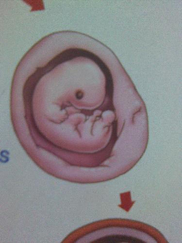 baby in utero - 
this is a baby.