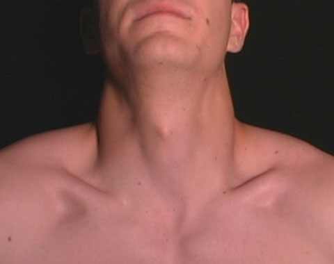 The neck - The neck is the part of the body, on many terrestrial or secondarily aquatic vertebrates, that distinguishes the head from the torso or trunk. The Latin term signifying "of the neck" is cervical The neck - The neck is the part of the body, on many terrestrial or secondarily aquatic vertebrates, that distinguishes the head from the torso or trunk. The Latin term signifying "of the neck" is cervical