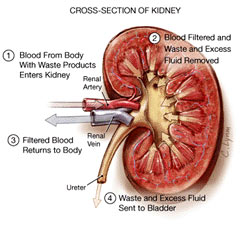 kidney - how kidney failure causes