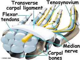 Carpal Tunnel - Carpal tunnel syndrome can cause pain and other symptoms in the hand. It is caused by pressure on a nerve around the wrist. Treatment is usually effective.