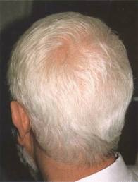Losing time and gaining grey hair - grey hair on your head Losing time and gaining grey hair - grey hair on your head