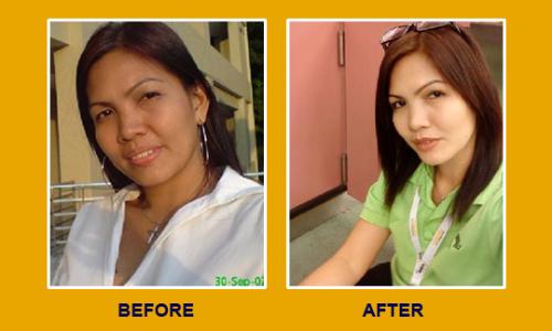 before and after - skin lightening Pills.