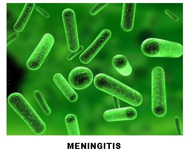 Meningitis - Viruses