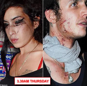 amy winehouse picture - amy winehouse and blake felder-civil covered in scratches amy winehouse picture - amy winehouse and blake felder-civil covered in scratches