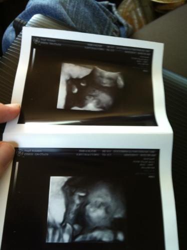 Ultra Sound photos - Pics from Kristen's last ultrasound