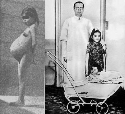 youngest mother - Name: Lina Medina
Born: September 27, 1933 (Ticrapo, Peru)
Nationality: Peruvian
