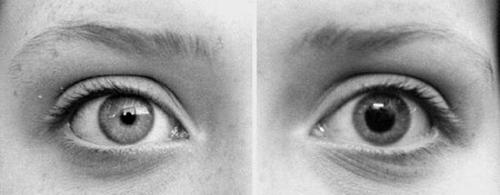 Eyes - What color is yours?