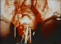 abortion1 - This is an abortion!