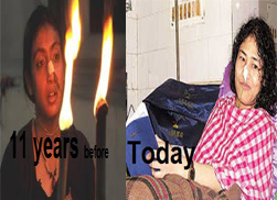 erome sharmila - erome sharmila 11 years before at the age of 18 and now erome sharmila - erome sharmila 11 years before at the age of 18 and now