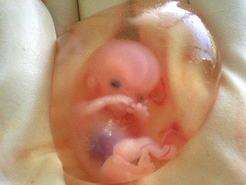 an angel  - fetus baby