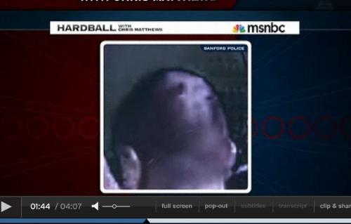 Zimmerman's head wound - The infamous non bleeding head wound that isn't there.