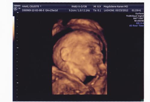 ultrasound picture of baby - Here is my ultrasound picture of my unborn son. 