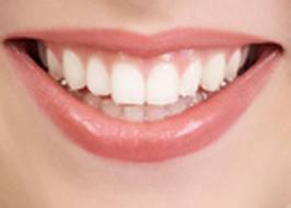 white teeth - An App to whiten your teeth