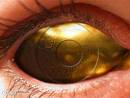 golden eye - golden eye