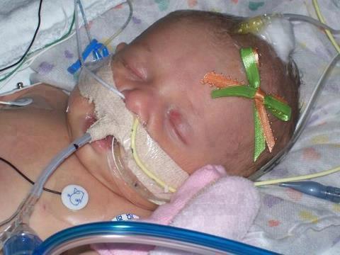Very sick baby - Pray for her please?