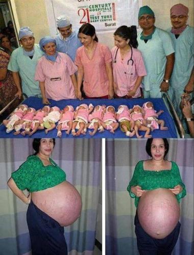 11 babies - An Indian women give birth to 11 healthy babies