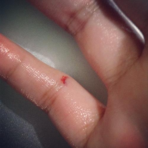 my cut finger - i cut my finger on broken glass on an early monday morning my cut finger - i cut my finger on broken glass on an early monday morning