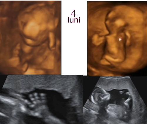 4 month ultrasound - our baby at 4 months ultrasound