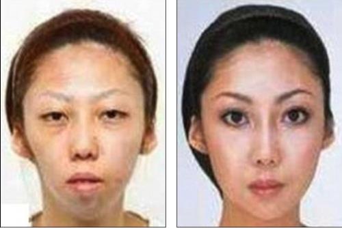 Cosmetic Surgery - Is it a crime to undergo cosmetic surgery? For this woman's case, I believe her judgment proves to be so where she became $120,000 poorer. Cosmetic Surgery - Is it a crime to undergo cosmetic surgery? For this woman's case, I believe her judgment proves to be so where she became $120,000 poorer.