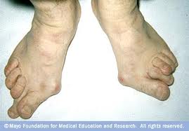 high heel effect - high heel effect image high heel effect - high heel effect image