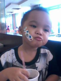 my lil boy - my little guy with a bruised cheek, i had to put some elmo band aid to cover the cut..but you could see the black bruising at the sids..

i had to treat him to some jollibee! 