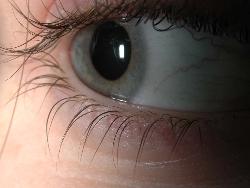 Eye - Eye