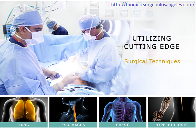 Are you looking for a thoracic surgeon in Los Angeles? West Coast Associates for Minimally Invasive Surgery is here for you. Call 310.854.0909 today. Are you looking for a thoracic surgeon in Los Angeles? West Coast Associates for Minimally Invasive Surgery is here for you. Call 310.854.0909 today.