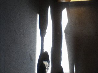 Photo: my leg (when I wtill had one)