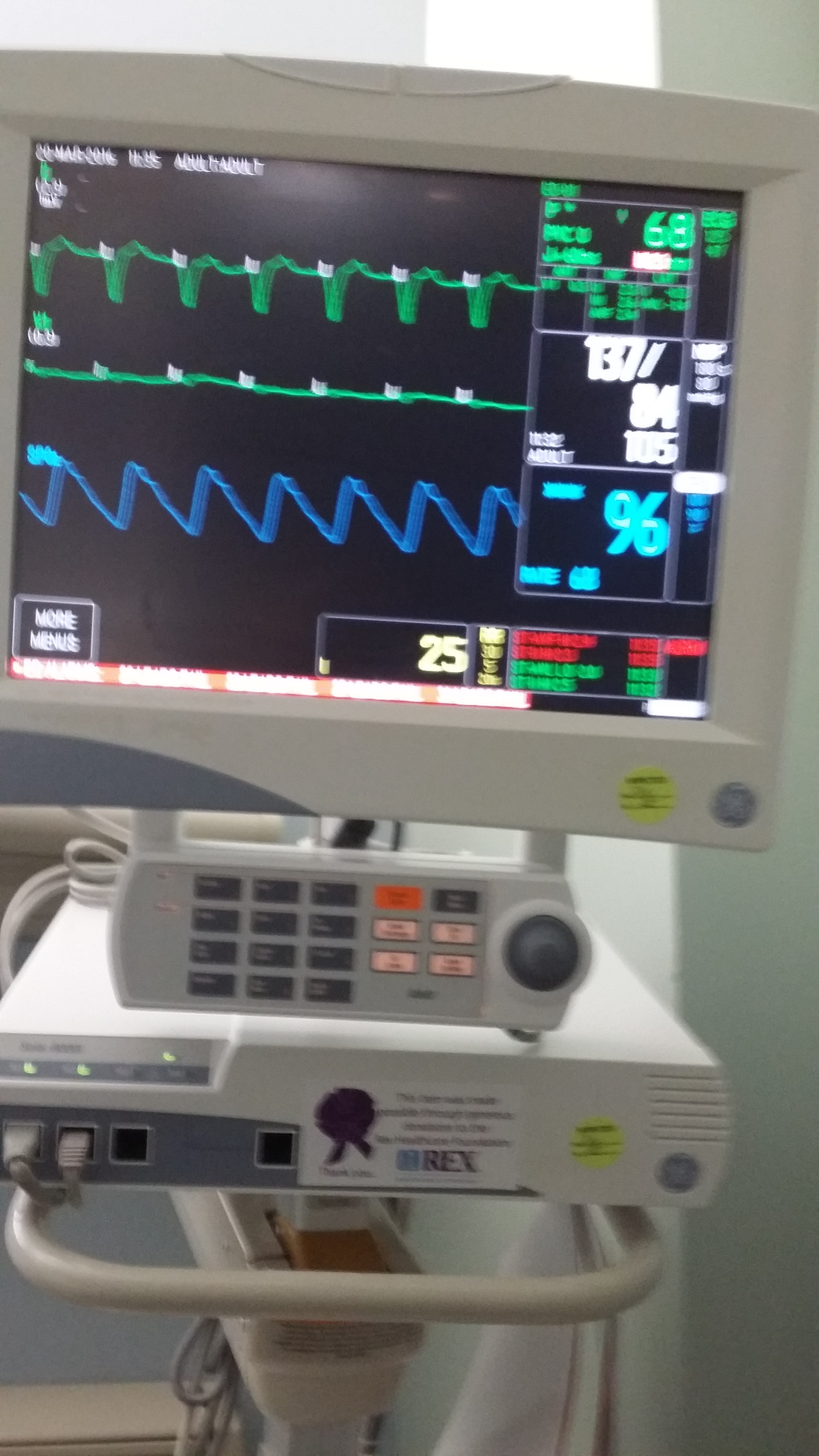 Heart monitor for Skip Heart monitor for Skip