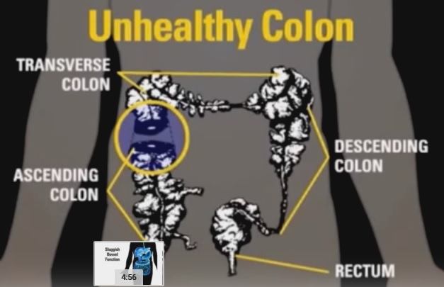 colon,intestines