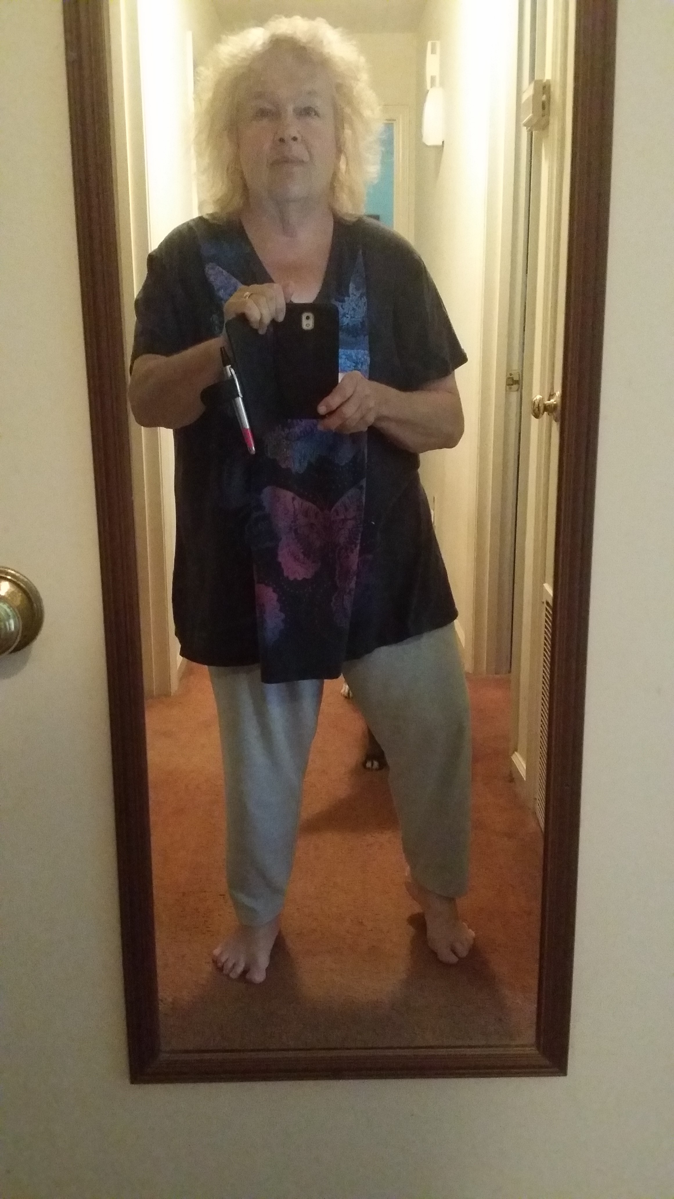 Weight Loss Surgery ... My Loose Clothes! Weight Loss Surgery ... My Loose Clothes!