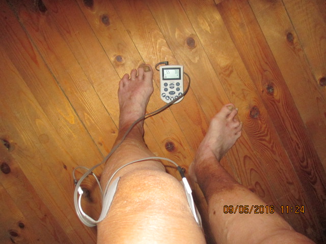 Wearing a TENS unit. © Marsha Musselman 2016 Wearing a TENS unit. © Marsha Musselman 2016