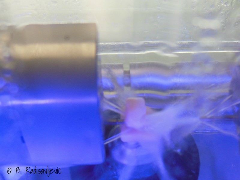 Crown in Process of Creation at Dental Office