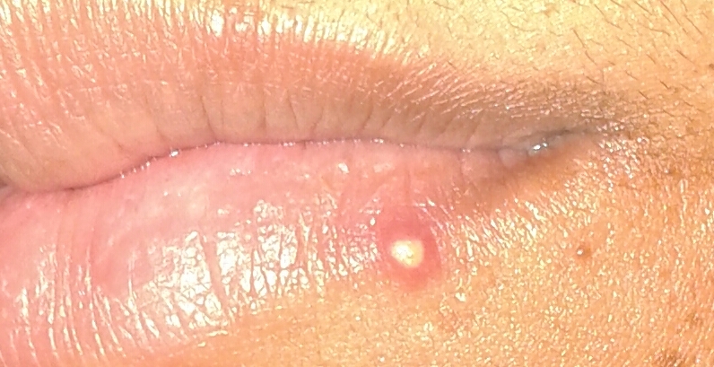 Sweaty Upper Lip Alert Meaning