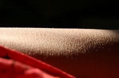 My skin more or less looks like this. My skin more or less looks like this.