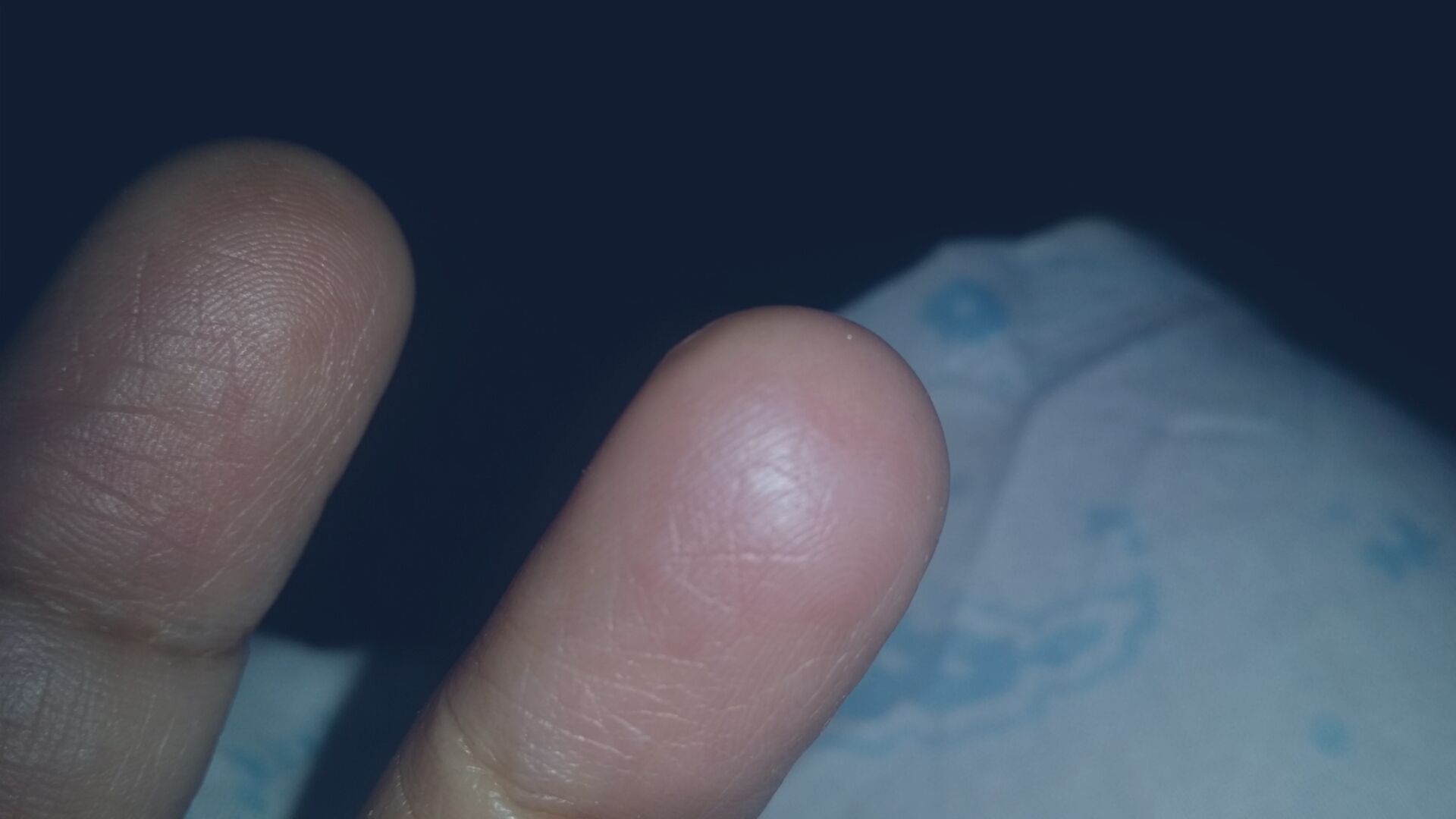 my finger