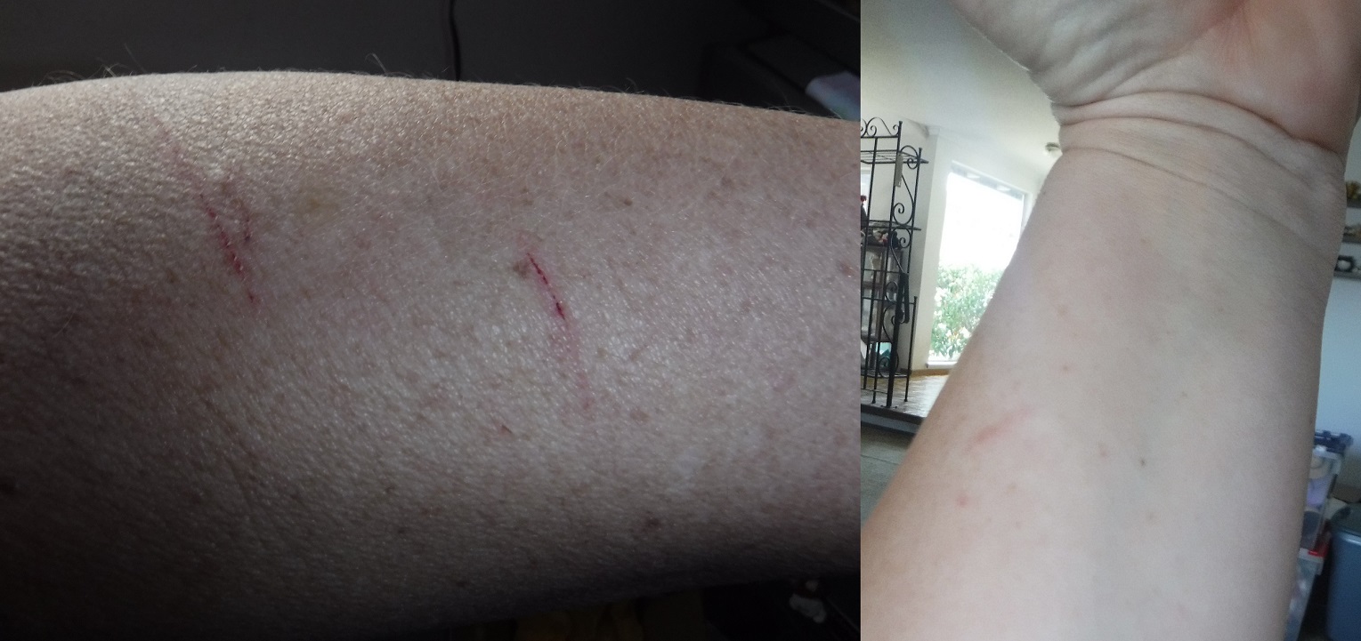 Photos I took of my arm an collaged Photos I took of my arm an collaged