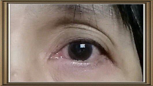 my left red eye my left red eye