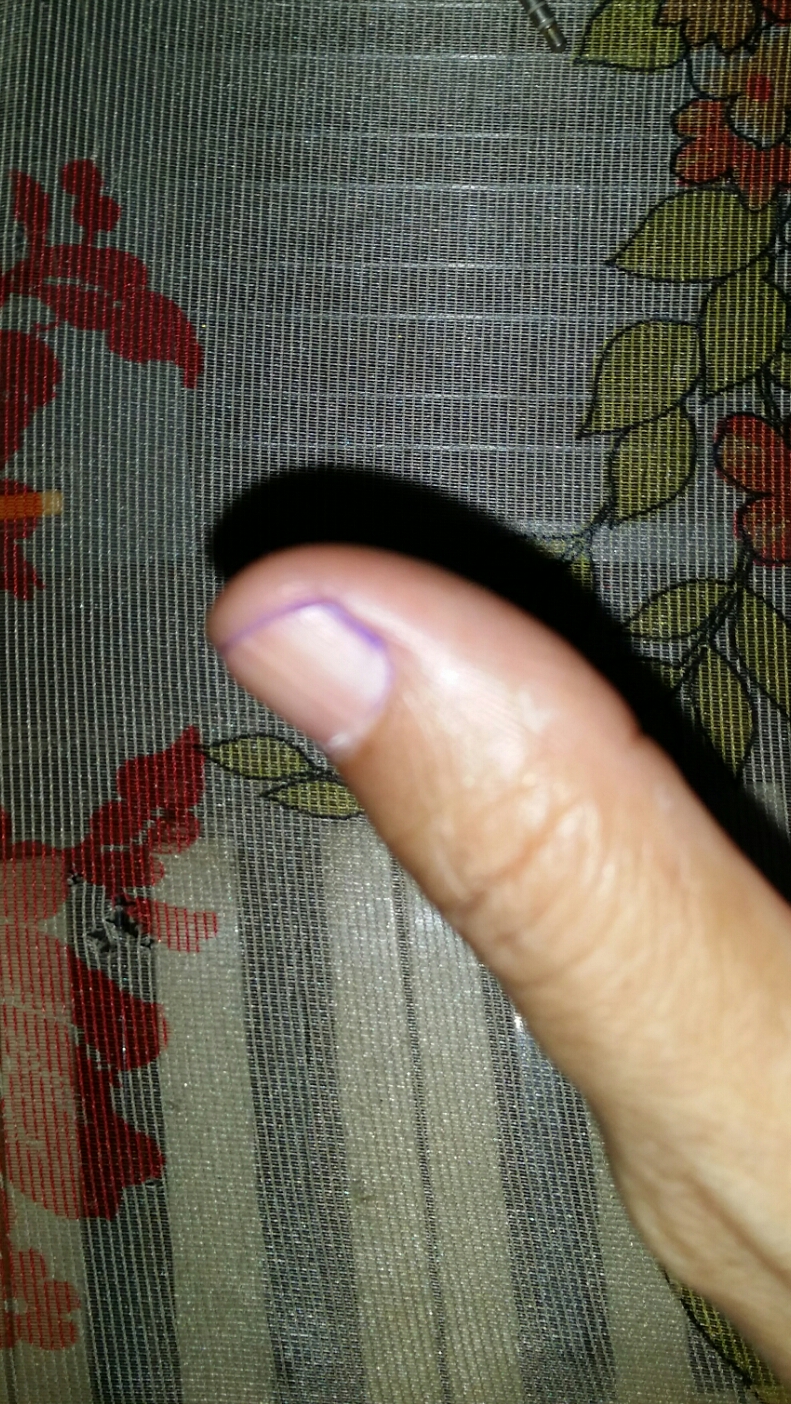 my thumb with the ink it was gone with a spray of alcohol 