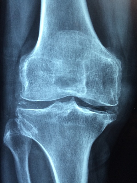 https://pixabay.com/en/knee-old-care-injury-pain-1406964/ https://pixabay.com/en/knee-old-care-injury-pain-1406964/
