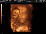 4D Ultrasound - This is my little Michael and his 4d Ultrasound.