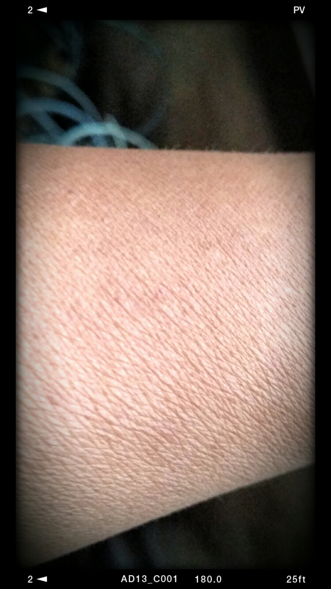 my skin my skin
