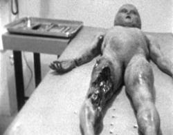 alien autopsy - a famous alien autopsy