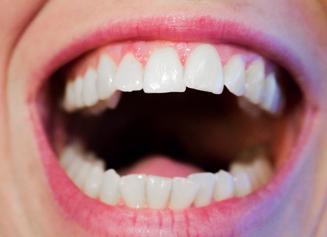 https://pixabay.com/en/teeth-dentist-dental-mouth-white-1652937/ https://pixabay.com/en/teeth-dentist-dental-mouth-white-1652937/