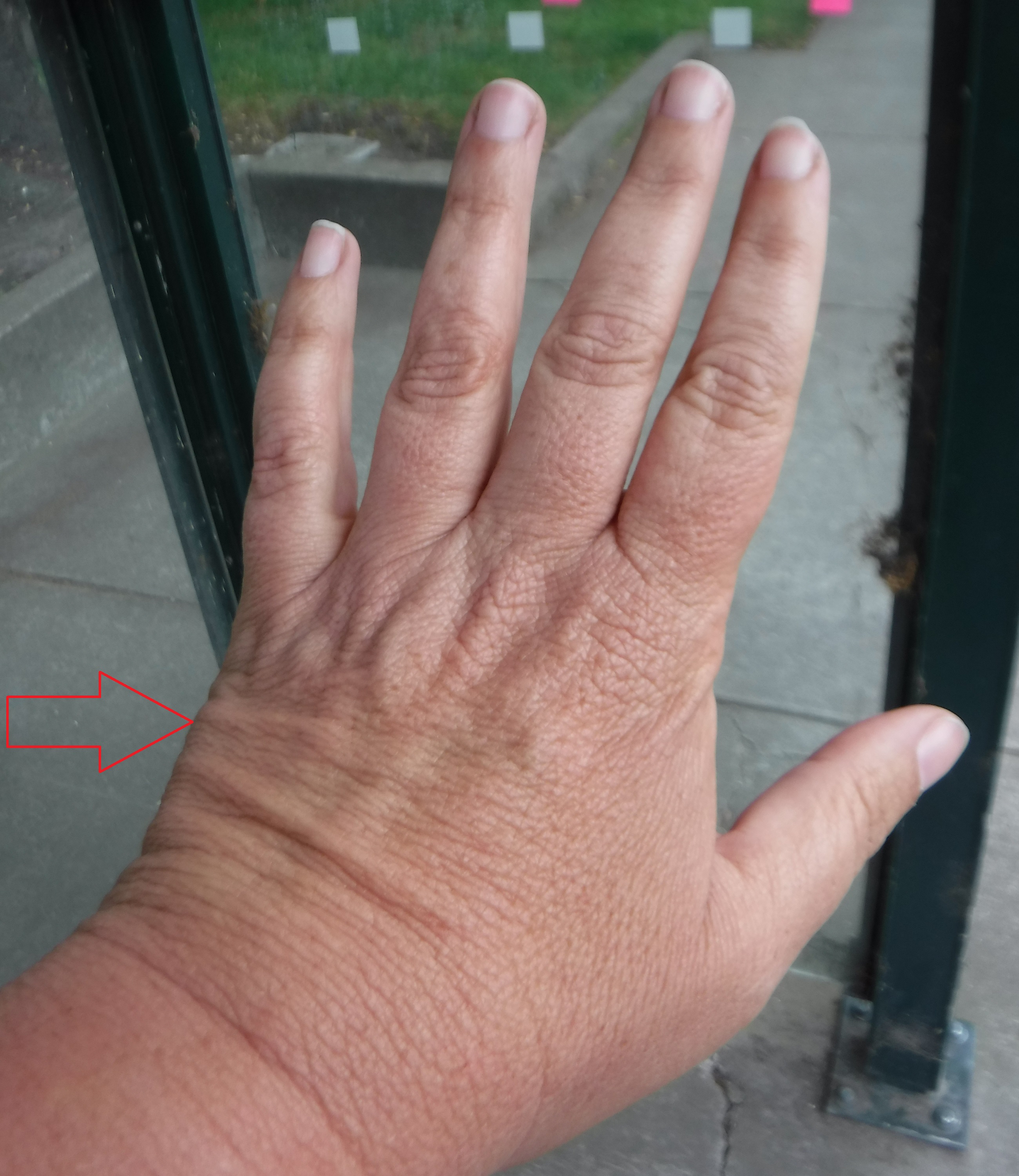 Photo I took of my hand at the Health Center bus stop Photo I took of my hand at the Health Center bus stop
