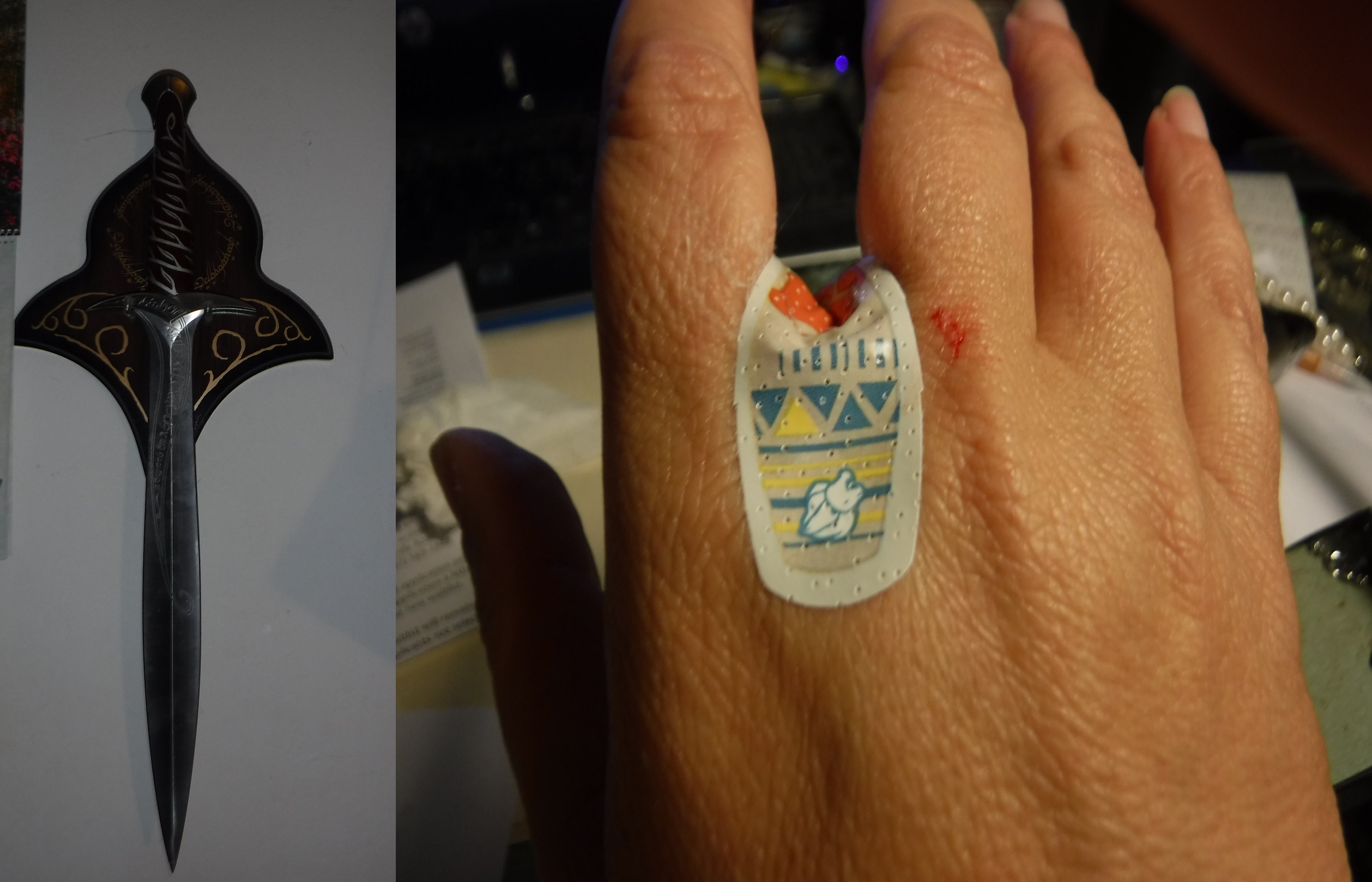 Photos I took of my Sting replica and my "ouched" hand Photos I took of my Sting replica and my "ouched" hand