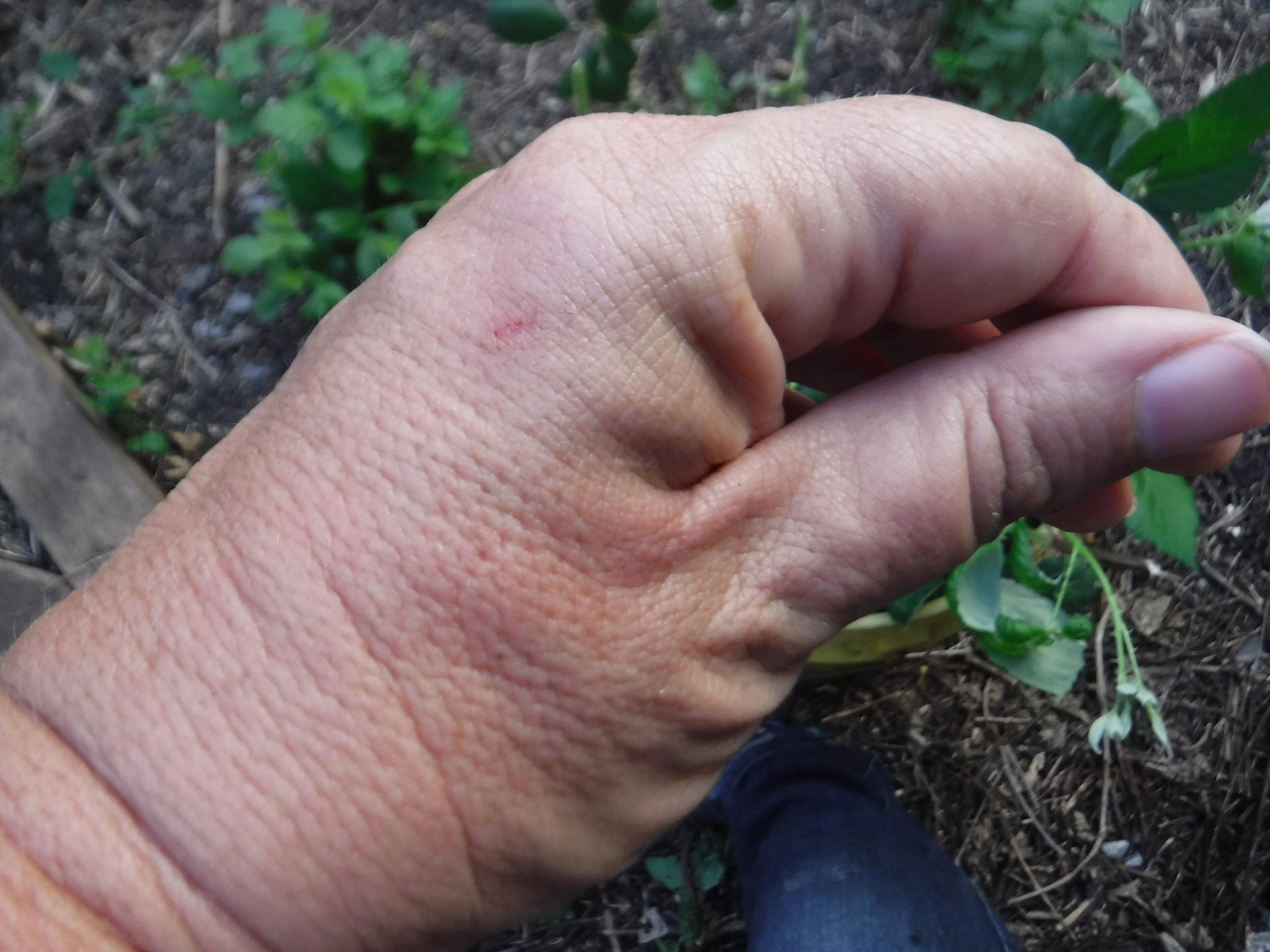 Photo I took of my hand that got burned/"bit" by a blackberry thorn at the side of the house Photo I took of my hand that got burned/"bit" by a blackberry thorn at the side of the house