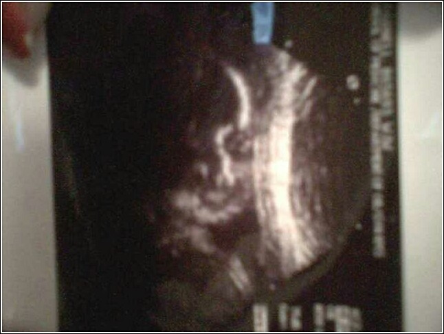 baby - the baby in my belly! its a boy
