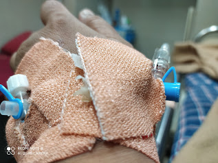 Intravenous injections